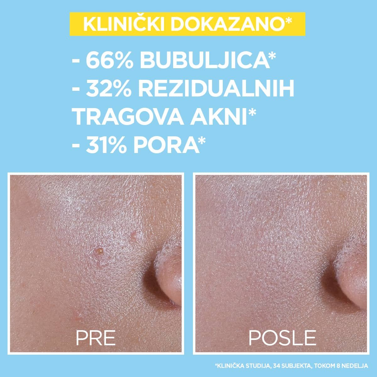 Garnier Pure Active matirajući fluid za zaštitu od sunca SPF50+, 40 ml | VESNA.RS
