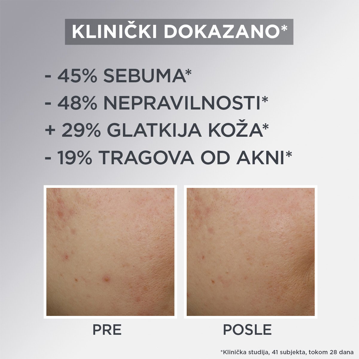 Garnier Pure Active Charcoal Air matirajuća krema protiv nepravilnosti, 50 ml | VESNA.RS