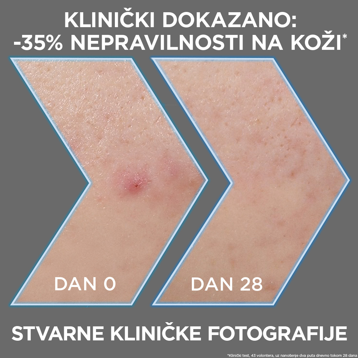 Garnier Pure Active Anti-Imperfection crni serum, 30ml | VESNA.RS