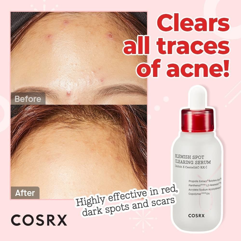 COSRX Serum za problematičnu kožu BLEMISH SPOT CLEARING SERUM | VESNA.RS